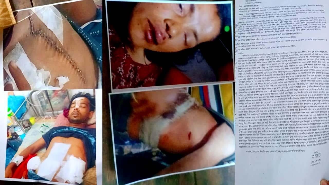 দুর্গাপুরে তিনজনকে কুপিয়ে-পিটিয়ে জখম, পাঁচজনের বিরুদ্ধে মামলা